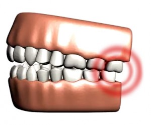 Headache relief can be achieved for patients with TMD in the Oceanside, Fallbrook, and Vista CA areas using TMJ treatment provided by Dr. Stephen Dankworth and Dr. Kimberly Corrigan-Dankworth.