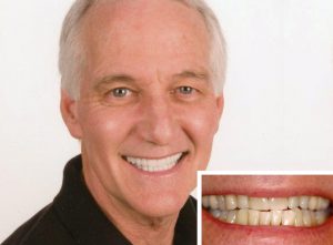Sedation dentistry patient loves receiving laughing gas in Oceanside during his dental procedures.